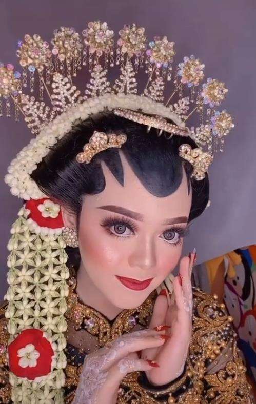 Transformasi wajah pengantin penuh luka jadi mulus dan flawless.