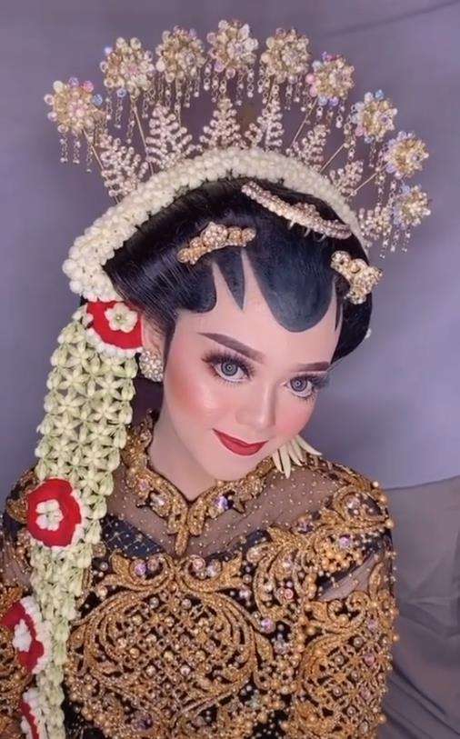 Transformasi wajah pengantin penuh luka jadi mulus dan flawless.