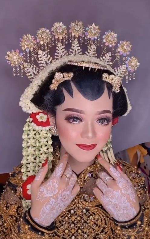 Transformasi wajah pengantin penuh luka jadi mulus dan flawless.
