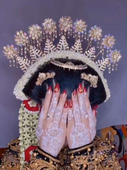 Transformasi wajah pengantin penuh luka jadi mulus dan flawless.