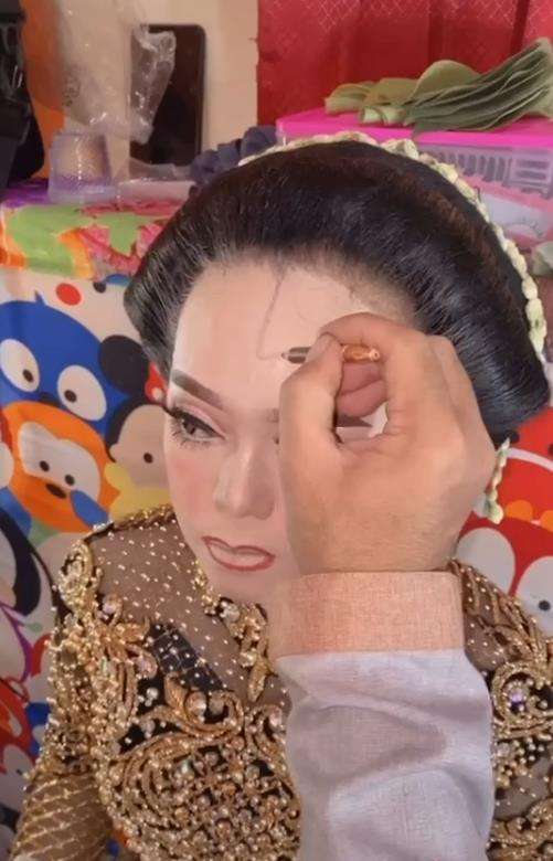 Transformasi wajah pengantin penuh luka jadi mulus dan flawless.