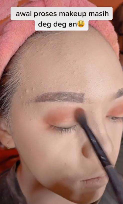 Transformasi wajah pengantin penuh luka jadi mulus dan flawless.