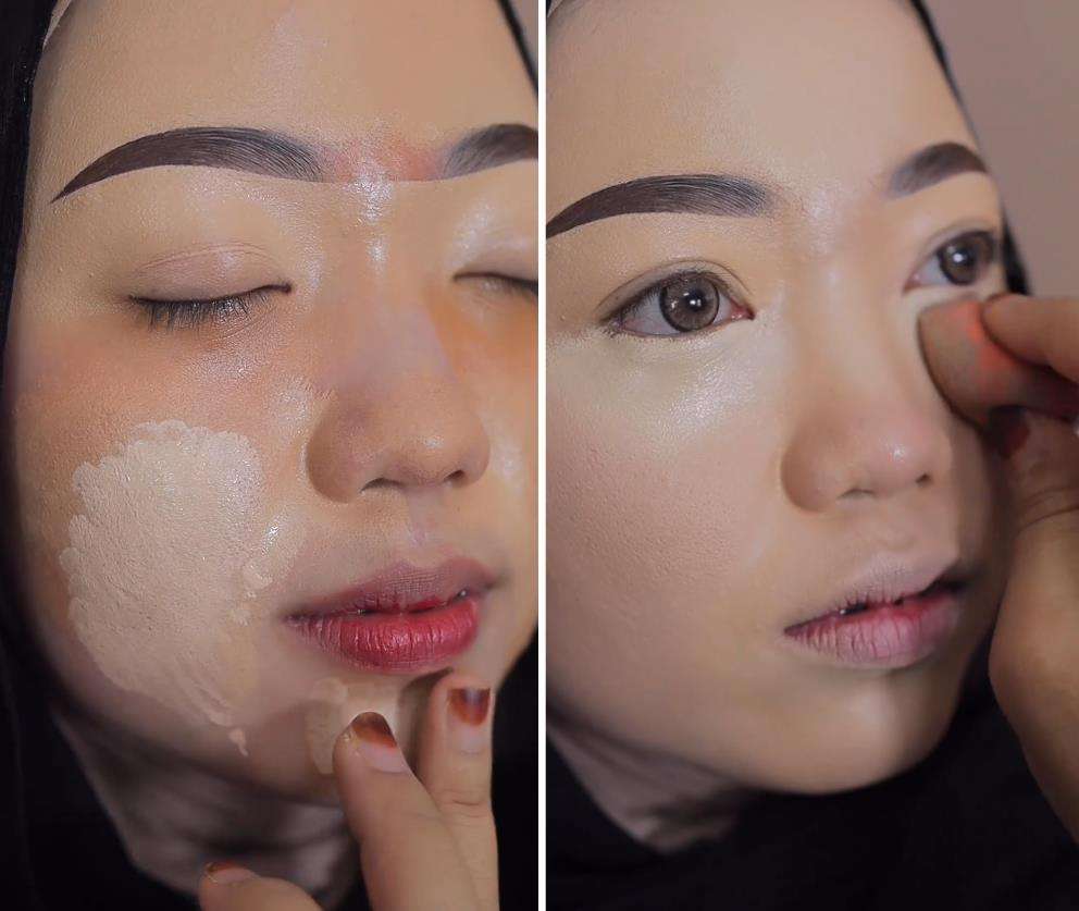 Transformasi wajah berjerawat parah jadi natural dan flawless.