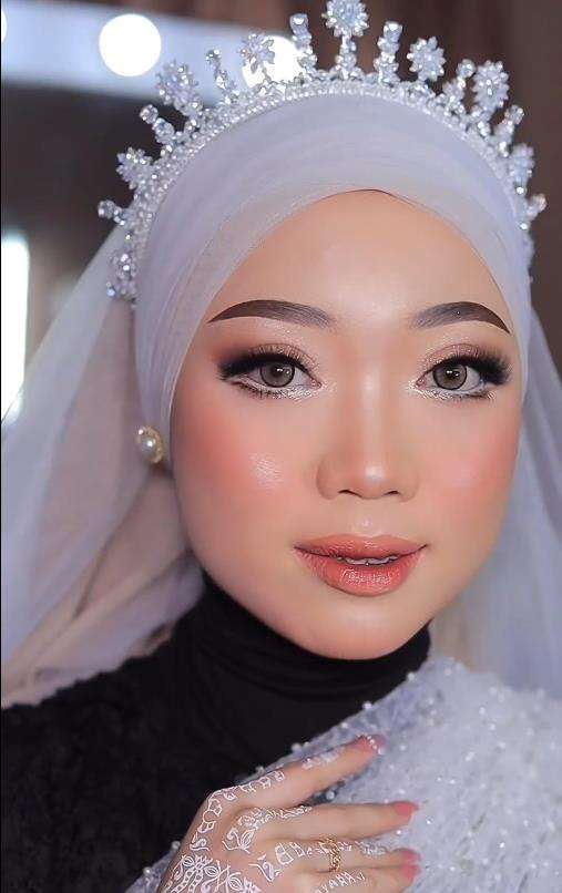 Transformasi wajah berjerawat parah jadi natural dan flawless.