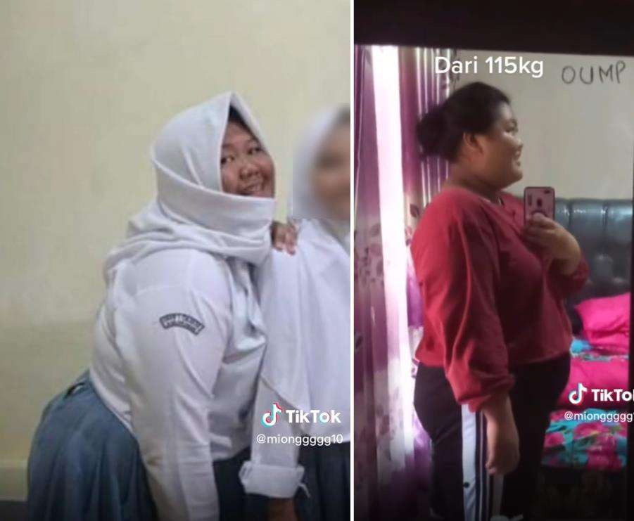 Awalnya, Mia mengalami obesitas dengan bobot 115kg.