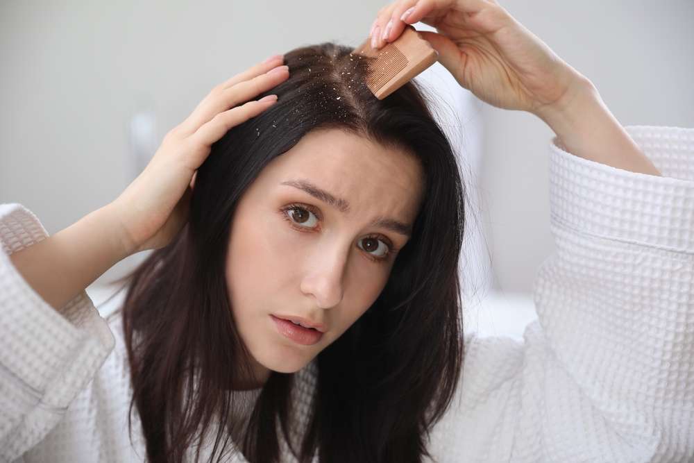 Jadi ‘Musuh Terbesar’ Bagi Hijabers, Ini 3 Permasalahan Rambut yang Mengganggu dan Cara Mengatasinya