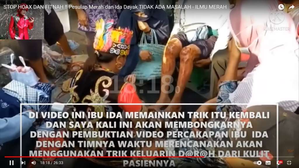 Pesulap Merah Bongkar Trik Jadul Ida Dayak, Oles Minyak Keluarkan Darah