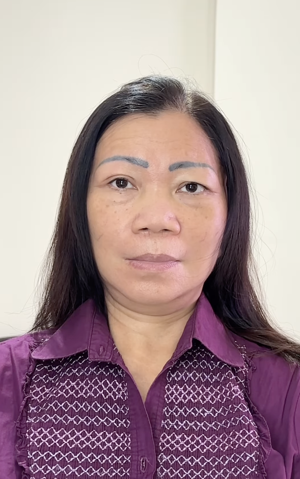 Memakai Eyelid Tape