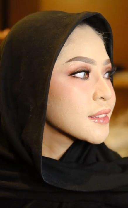 Transformasi makeup pengantin siger Sunda penuh jerawat.