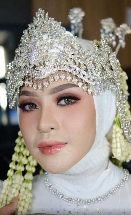 Transformasi makeup pengantin siger Sunda penuh jerawat.