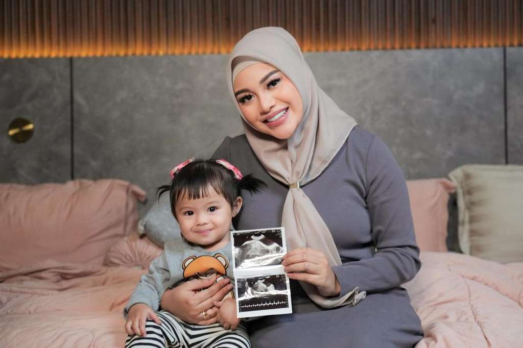 Aurel hamil anak kedua