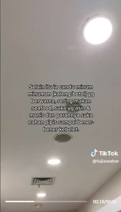 Awalnya Sakit Pinggang Ternyata Ada Batu Ginjal Sebesar Jahe di Tubuh Pasien Wanita, ini Penyebabnya