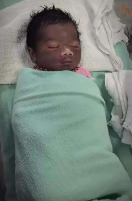Cerita ibu lahirkan bayi dengan wajah lebam.