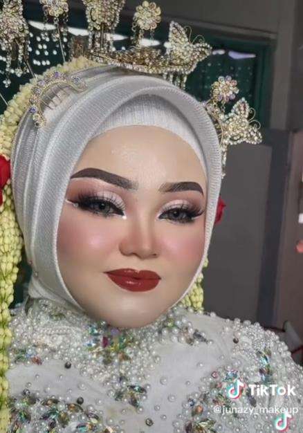 Transformasi wajah pengantin berjerawat batu.