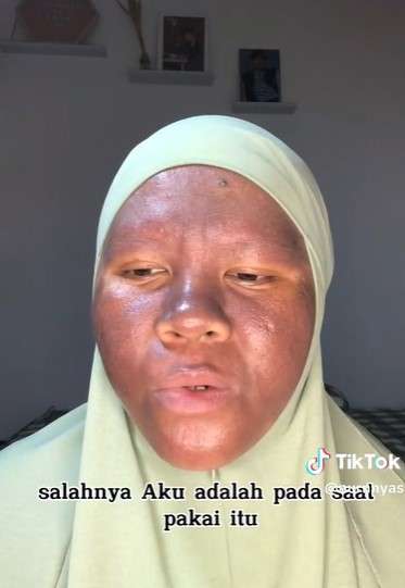 Cerita TikToker Seputar Kulit