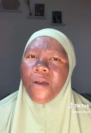 Cerita TikToker Seputar Kulit