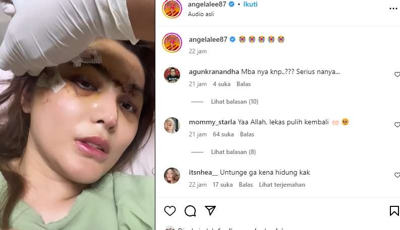angela