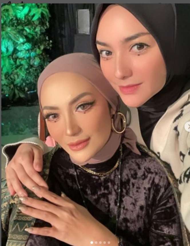 Disebut Mirip Banget, Adu Pesona Citra Kirana dan Imel Putri Cahyati