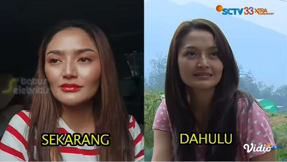 Penampilan Sibad dulu dan sekarang