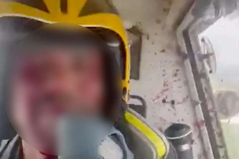 Burung Raksasa Tabrak Pesawat Hingga Nyangkut di Kokpit, Pilot Tetap Santai Berhasil Mendarat dengan Selamat