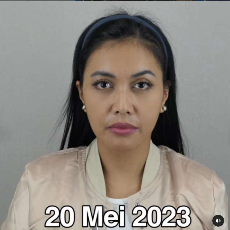Penampilan Denada sebelum tindakan