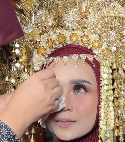 Memakai Obat Tetes Mata