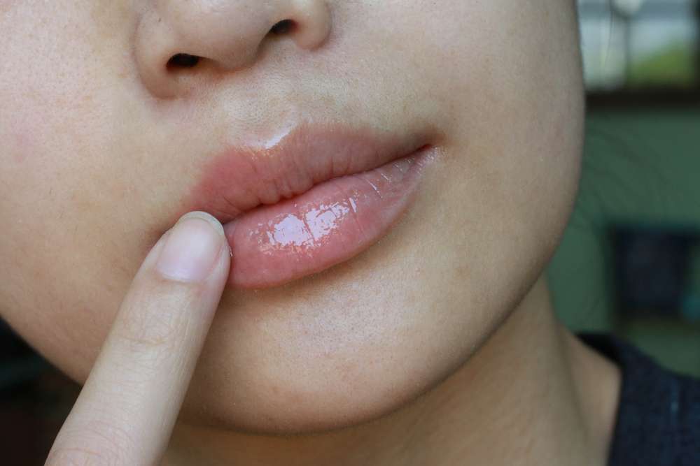 Lip balm