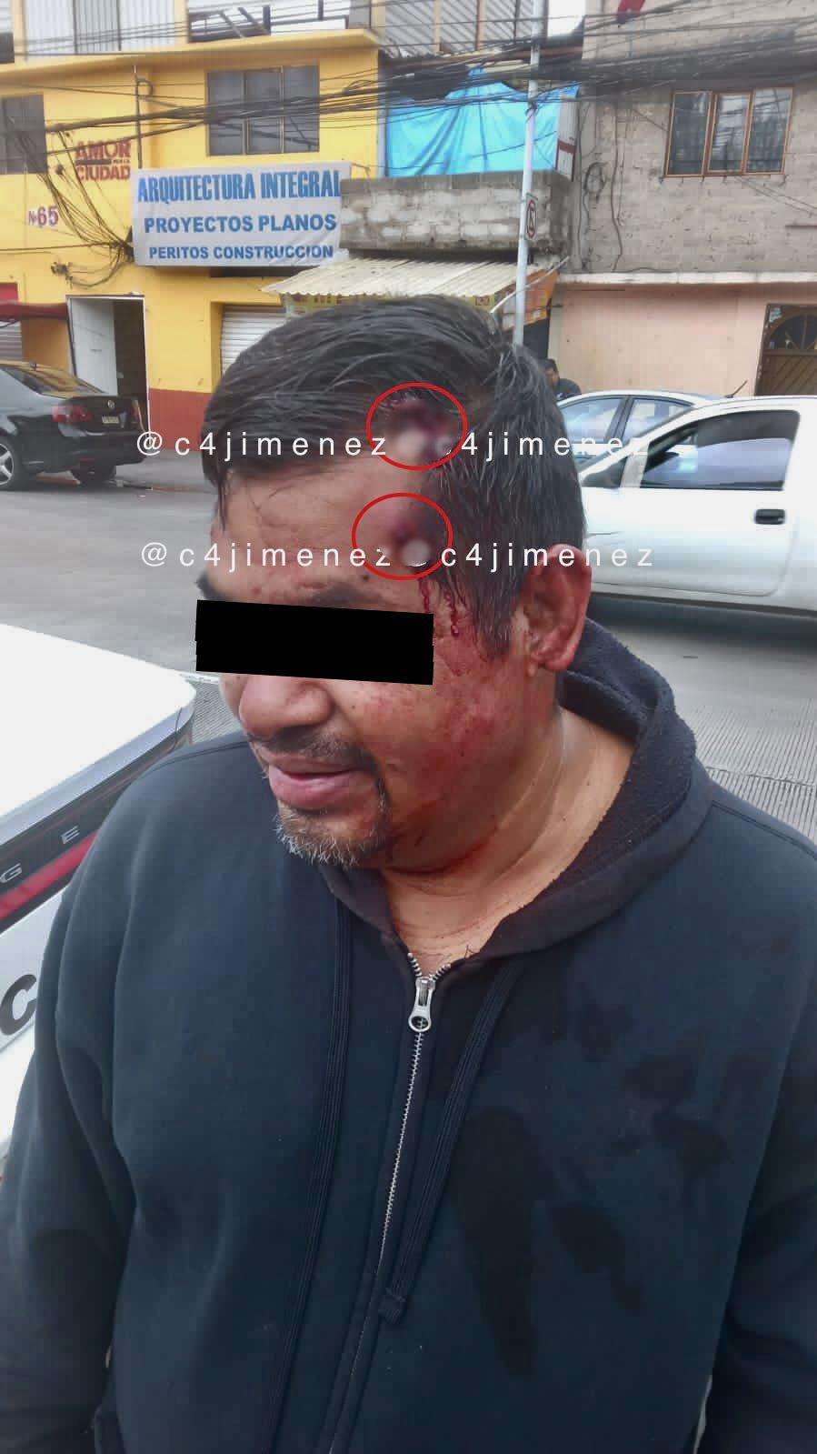 Ditembak dua kali dalam jarak dekat, pria tetap selamat.