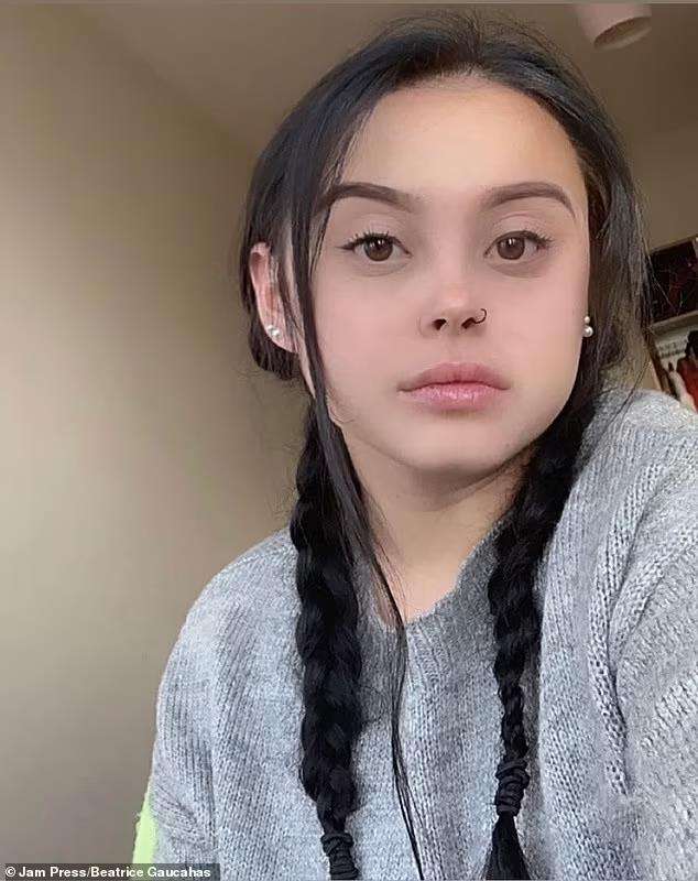 Gadis cantik idap eksim parah, kulitnya seperti kena luka bakar.