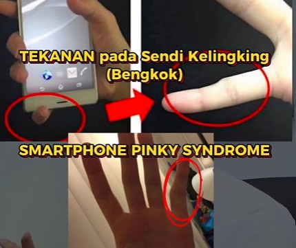 Menyangga HP dengan Kelingking