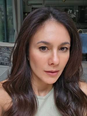 Kondisi Kulit Wajah Viral, Wulan Guritno: Bersyukur Jejak Digital Itu Ada