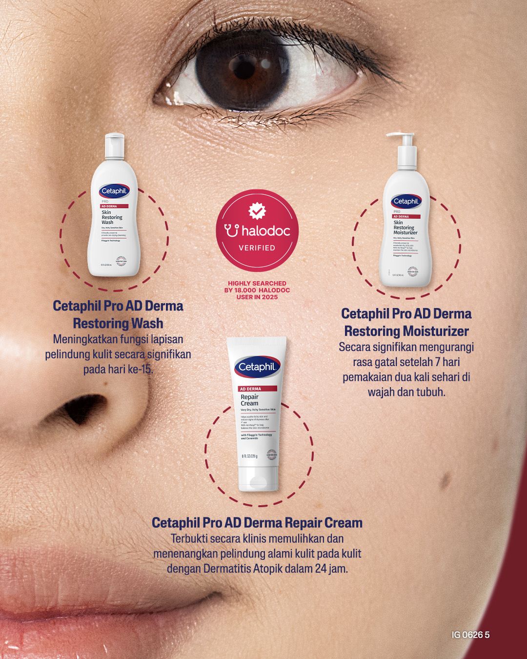 Cetaphil Pro AD Derma Cetaphil Pro AD Derma
