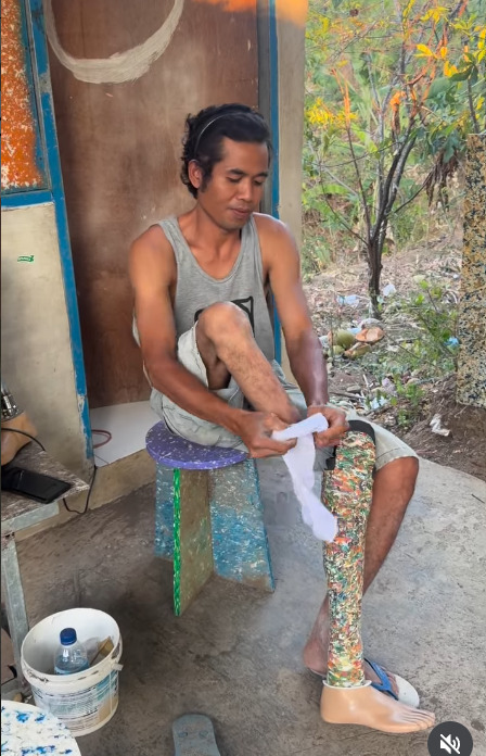 Subhan, penerima bantuan kaki palsu (Instagram @yayasankakikita) Subhan, penerima bantuan kaki palsu (Instagram @yayasankakikita)
