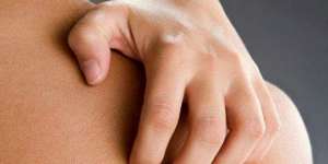 Saat Anak Mengeluh Gatal, Jangan Digaruk!