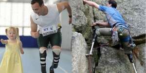 Kisah Atlet dengan Organ Tubuh Palsu 