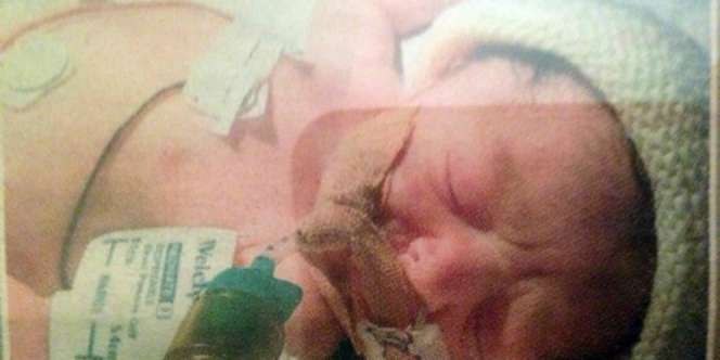 Kisah Maisy, si Gadis Kecil yang Terlahir Tanpa Darah