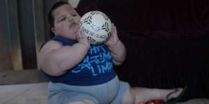 Berat Badan Bocah 3 Tahun Ini 70 Kilogram