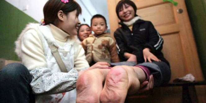 Kegigihan Wanita Berkaki Terbalik: Jangan Kasihani Saya!