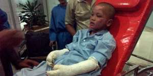 Hafiz Cilik Depok Luka Bakar 40%, Butuh Bantuan Biaya
