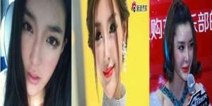 Operasi Plastik Kedaluwarsa Ubah Model Cantik Jadi Mengerikan