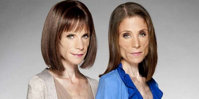 Kisah Pilu Penderita Anorexia