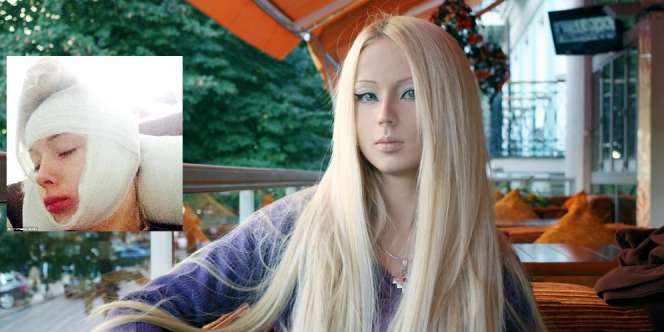 `Manusia Barbie` Dihajar Dua Pria Tak Dikenal Saat Halloween