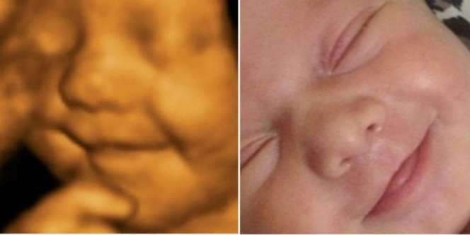 Bayi Ini Sudah Suka Senyum saat Masih di Kandungan