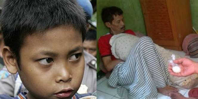 Kisah Fenomenal `Batu Petir` Ponari Sampai `Pria Bertelur`