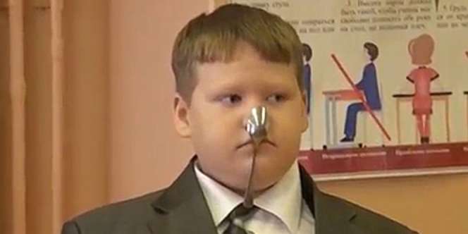 Bocah Ini Punya Kekuatan Super Usai Tersengat Listrik