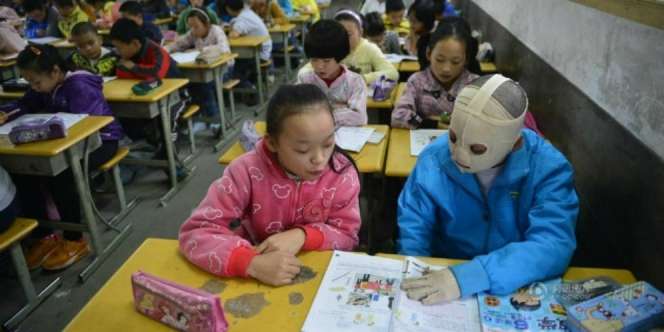 Tak Pedulikan Penampilan, Bocah Ini Tetap Masuk Sekolah