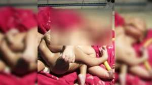 Geger `Bayi Dewa`, Punya 4 Kaki dan 4 Tangan