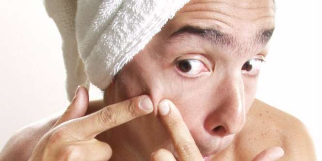 Awas! Sering Cuci Muka Picu Timbulkan Jerawat