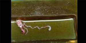 Santap Makanan Kurang Matang, Cacing Bersarang di Otak
