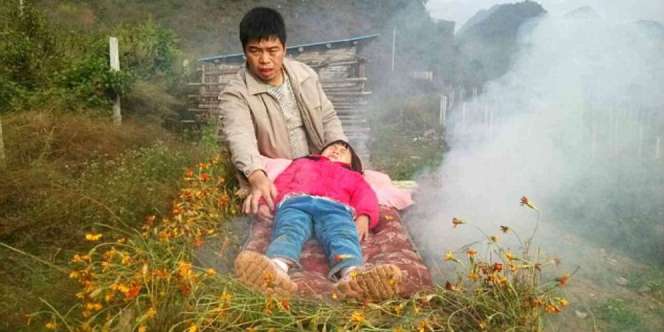 Tak Punya Biaya Berobat, Ayah `Bakar` Anak
